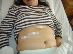 ������50���㵨��ȡ��289�ŵ�